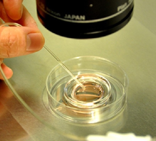 試管嬰兒如何降低胚胎碎片率？