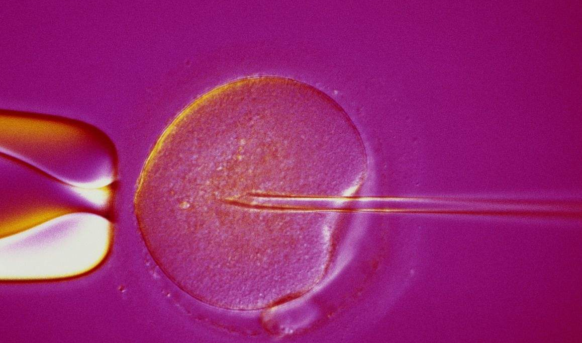 人工授精是什么？失敗了可以做試管嬰兒?jiǎn)幔? /></a>
	<div   id=