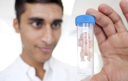 如何防止做試管嬰兒后發(fā)生腹水？