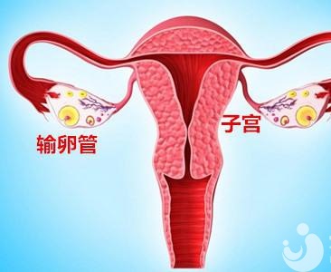 輸卵管積水是先做通水手術(shù)，還是試管嬰兒？