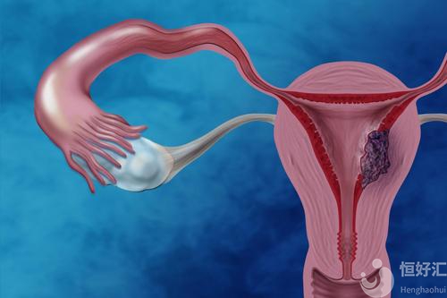 子宮內(nèi)膜薄能否做試管治療？要怎么辦？
