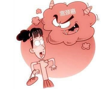 不用檢查也能知道是宮頸癌，看哪些癥狀？