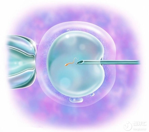 第二代試管技術(shù)的成功率高嗎？
