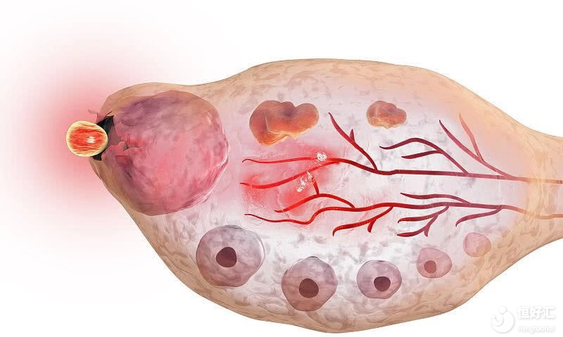 卵巢功能減退，是誰的錯？