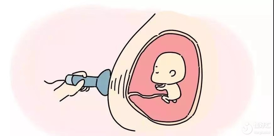 為什么要做NT檢查，有什么好處嗎？