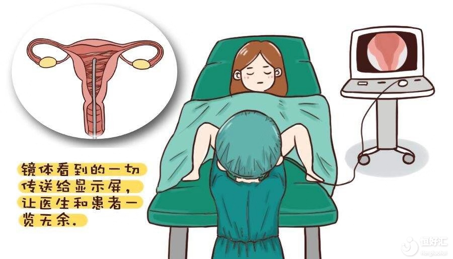 宮腔粘連治療后還會復發(fā)嗎？