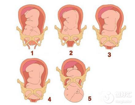 懷孕既幸福又忐忑，關于孕期變化，你中了幾個？