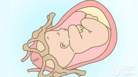 胎兒入盆會(huì)有感覺(jué)嗎？這幾點(diǎn)也許你想不到