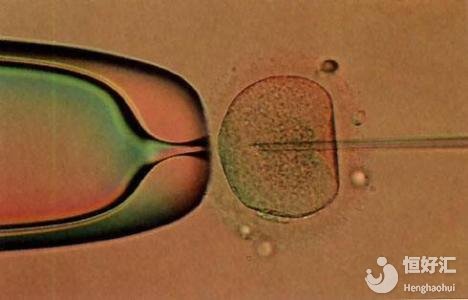 試管嬰兒自然周期也有這些優(yōu)勢(shì)，可惜很多人不知！