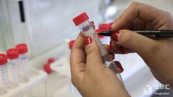 試管知識之準爸爸取精期間哪些必須要注意？