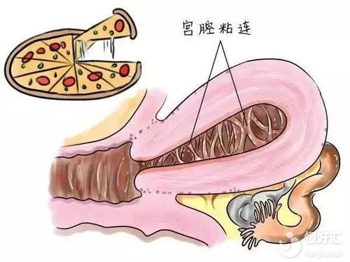 大齡做試管嬰兒也許有這些好處，很多人都忽略了！