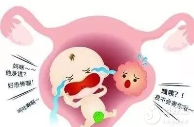 子宮肌瘤和懷孕能否共存？看完這個秒懂！